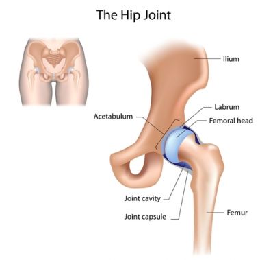 hip_pain.jpg