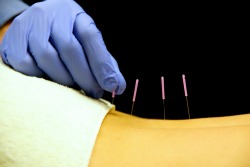 NeedleBack.jpg